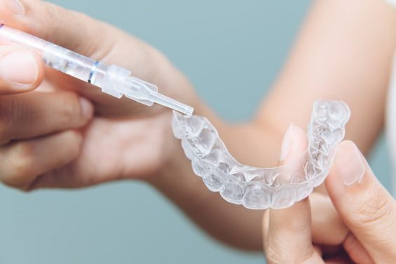 Partial Dentures — Mid North Coast Dentures & Mouthguards in Kempsey, NSW