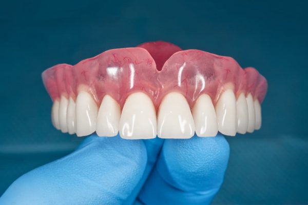 Complete Dentures — Mid North Coast Dentures & Mouthguards in Kempsey, NSW