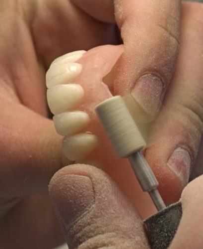 Working on a denture — Mid North Coast Dentures & Mouthguards in Kempsey, NSW